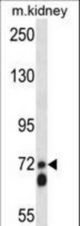 APLP2 Antibody western blot of mouse kidney tissue lysates (35 ug/lane). The APLP2 antibody detected the APLP2 protein (arrow).
