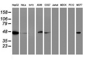 Western blot of extracts (35 ug) from 9 different cell lines by using anti-C20orf3 monoclonal antibody.