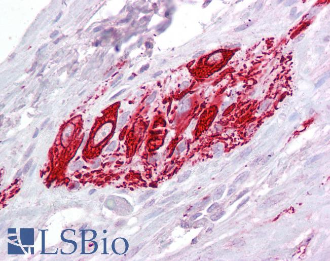 Anti-ITM2B antibody IHC of human small intestine, myenteric plexus. Immunohistochemistry of formalin-fixed, paraffin-embedded tissue after heat-induced antigen retrieval. Antibody LS-B6486 concentration 2.5 ug/ml.