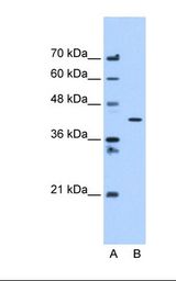 Lane A: Marker. Lane B: HepG2 cell lysate. Antibody concentration: 1.25 ug/ml. Gel concentration: 12%.