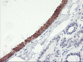 IHC of paraffin-embedded Human breast tissue using anti-C20orf3 mouse monoclonal antibody.