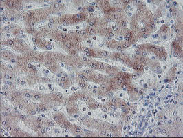 IHC of paraffin-embedded Human liver tissue using anti-C20orf3 mouse monoclonal antibody. (Heat-induced epitope retrieval by 10mM citric buffer, pH6.0, 100C for 10min).