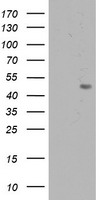 HEK293T cells were transfected with the pCMV6-ENTRY control (Left lane) or pCMV6-ENTRY C20orf3 (Right lane) cDNA for 48 hrs and lysed. Equivalent amounts of cell lysates (5 ug per lane) were separated by SDS-PAGE and immunoblotted with anti-C20orf3.