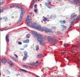 Formalin-fixed and paraffin-embedded human Placenta tissue reacted with APOA1 antibody , which was peroxidase-conjugated to the secondary antibody, followed by AEC staining. This data demonstrates the use of this antibody for immunohistochemistry; clinical relevance has not been evaluated.