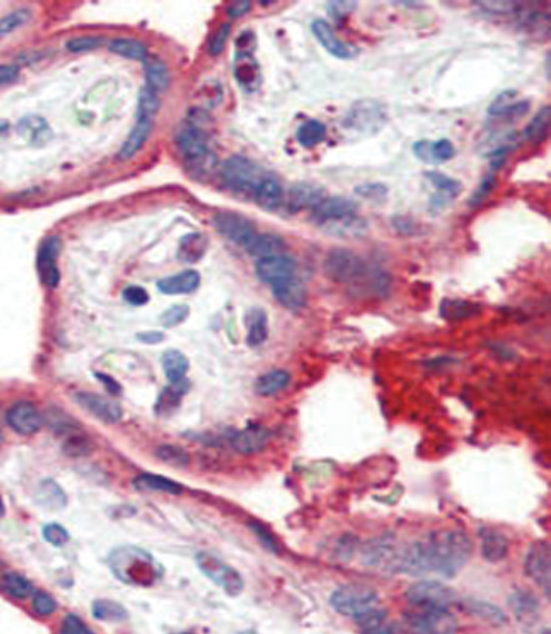 Formalin-fixed and paraffin-embedded human Placenta tissue reacted with APOA1 antibody , which was peroxidase-conjugated to the secondary antibody, followed by AEC staining. This data demonstrates the use of this antibody for immunohistochemistry; clinical relevance has not been evaluated.