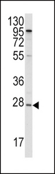Western blot of anti-APOA1 Antibody in HepG2 cell line lysates (35 ug/lane). APOA1(arrow) was detected using the purified antibody.