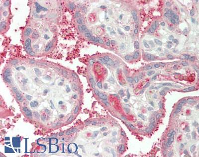 Human Placenta: Formalin-Fixed, Paraffin-Embedded (FFPE)