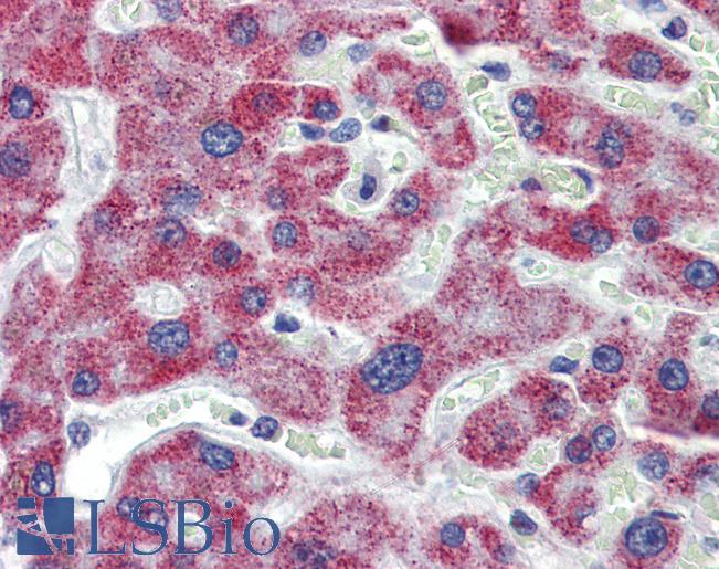 Anti-ACAA1 antibody IHC of human liver. Immunohistochemistry of formalin-fixed, paraffin-embedded tissue after heat-induced antigen retrieval. Antibody LS-B4015 concentration 5 ug/ml.
