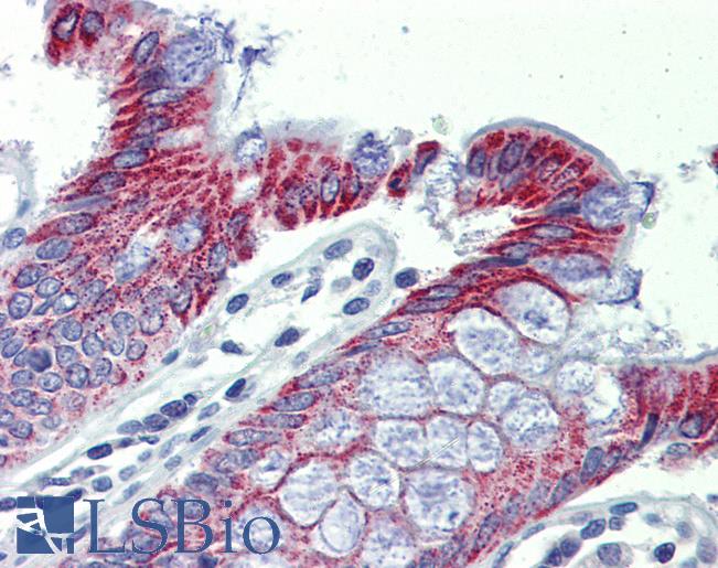 Anti-ACAA1 antibody IHC of human colon. Immunohistochemistry of formalin-fixed, paraffin-embedded tissue after heat-induced antigen retrieval. Antibody LS-B4015 concentration 5 ug/ml.