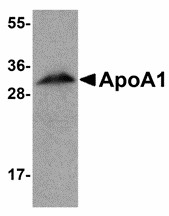 Western blot of ApoA1 in human liver tissue lysate with ApoA1 antibody at 1 ug/ml. Below: Immunofluorescence of ApoA1 in human liver tissue with ApoA1 antibody at 20 ug/ml.