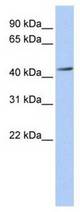 Western analysis of fetal brain lysate.