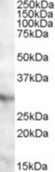Antibody (0.5 ug/ml) staining of Human Heart lysate (35 ug protein in RIPA buffer). Primary incubation was 1 hour. Detected by chemiluminescence