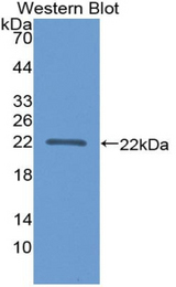 Western blot of recombinant APOA1BP.