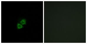 Immunofluorescence of A549 cells, using AIBP Antibody. The picture on the right is treated with the synthesized peptide.
