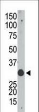 The anti-Apobec1 N-term antibody is used in Western blot to detect Apobec in mouse small intestine tissue lysate.