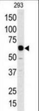 Western blot of anti-Apobec1 Antibody in 293 cell line lysates (35 ug/lane). Apobec1(arrow) was detected using the purified antibody.