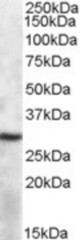 Antibody (1 ug/ml) staining of Mouse Spleen lysate (35 ug protein in RIPA buffer). Primary incubation was 1 hour. Detected by chemiluminescence
