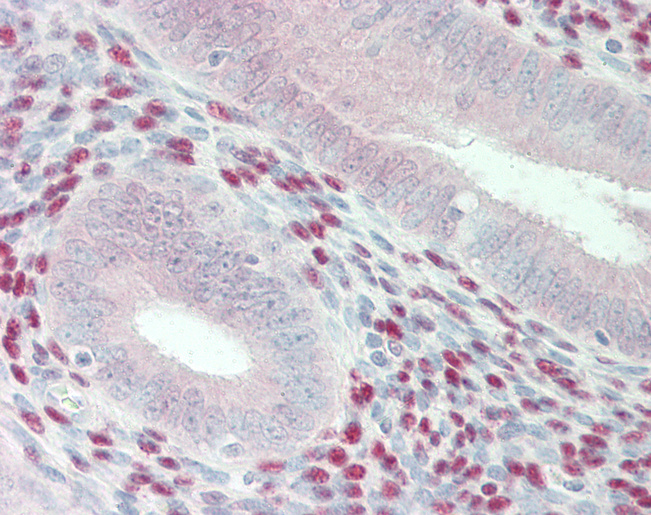 Human Uterus: Formalin-Fixed, Paraffin-Embedded (FFPE)