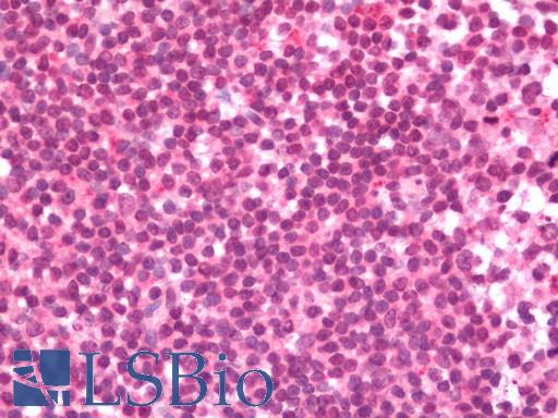 Human Tonsil: Formalin-Fixed, Paraffin-Embedded (FFPE)