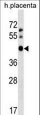 APOBEC3D Antibody western blot of human placenta tissue lysates (35 ug/lane). The APOBEC3D antibody detected the APOBEC3D protein (arrow).