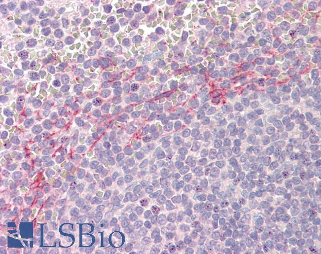 Human Spleen: Formalin-Fixed, Paraffin-Embedded (FFPE)