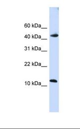 Fetal brain lysate. Antibody concentration: 1.0 ug/ml. Gel concentration: 10-20%.