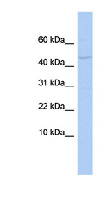 APOBEC3F antibody LS-C110500 Western blot of OVCAR-3 cell lysate.