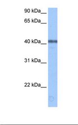 Brain cell lysate. Antibody concentration: 0.5 ug/ml. Gel concentration: 12%.