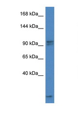 AAK1 antibody LS-C145232 Western blot of Mouse Thymus lysate. Antibody concentration 1 ug/ml.