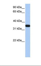 Fetal liver lysate. Antibody concentration: 1.0 ug/ml. Gel concentration: 12%.