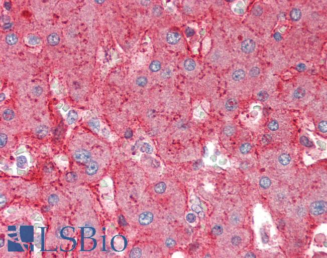 Anti-APOE / Apolipoprotein E antibody IHC of human liver. Immunohistochemistry of formalin-fixed, paraffin-embedded tissue after heat-induced antigen retrieval. Antibody LS-B2390 concentration 5 ug/ml.