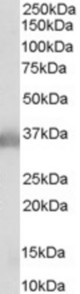 Antibody (0.1 ug/ml) staining of Human Brain lysate (35 ug protein in RIPA buffer). Primary incubation was 1 hour. Detected by chemiluminescence.