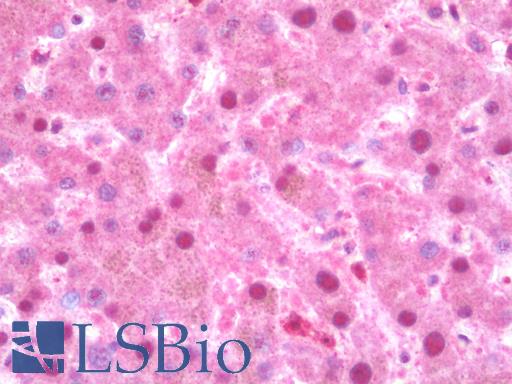 Anti-APOE / Apolipoprotein E antibody IHC staining of human liver. Immunohistochemistry of formalin-fixed, paraffin-embedded tissue after heat-induced antigen retrieval.