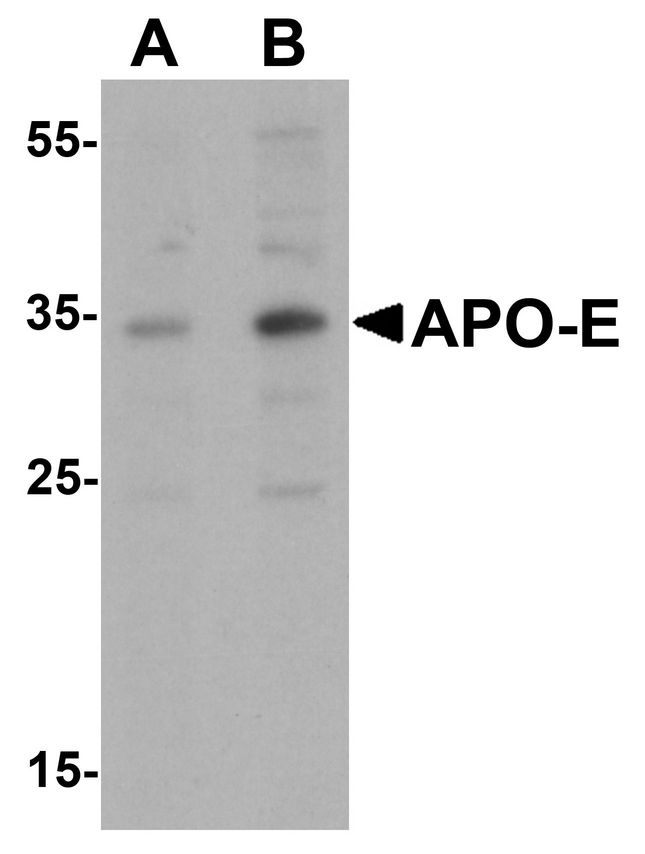 Western blot analysis of APO-E in human brain tissue lysate with APO-E antibody at (A) 0.5 and (B) 1 ug/ml.