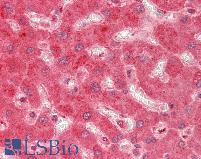 Human Liver: Formalin-Fixed, Paraffin-Embedded (FFPE)