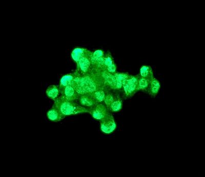 Immunofluorescent staining of HepG2 cells using anti-Apolipoprotein H antibody.
