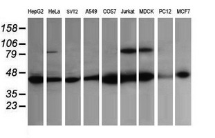 Western blot of extracts (35 ug) from 9 different cell lines by using anti-ACAA2 monoclonal antibody (HepG2: human; HeLa: human; SVT2: mouse; A549: human; COS7: monkey; Jurkat: human; MDCK: canine; PC12: rat; MCF7: human).