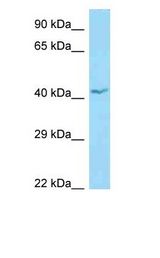 APOL1 / Apolipoprotein L antibody Western Blot of OVCAR-3.