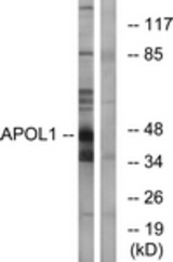 Western blot of extracts from A549 cells, using APOL1 Antibody. The lane on the right is treated with the synthesized peptide.
