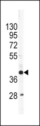 Western blot of APOL1 Antibody in SK-Br-3 cell line lysates (35 ug/lane). APOL1 (arrow) was detected using the purified antibody.