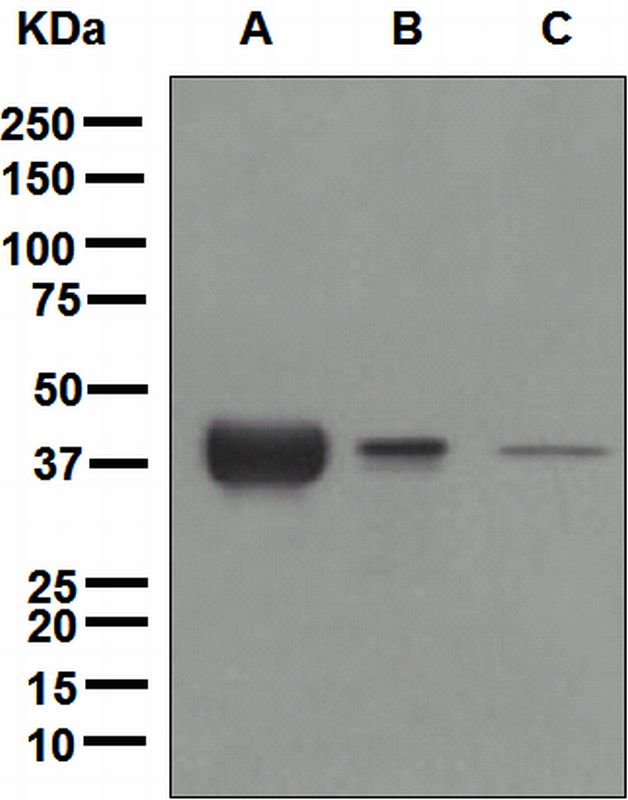 Western blot analysis on (A) human plasma, (B) ovary cancer, and (C) HepG2 cell lysates using anti-Apolipoprotein L1 antibody.
