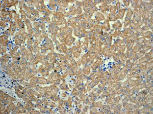 IHC of paraffin-embedded human liver tissue using anti-APOL1 antibody.