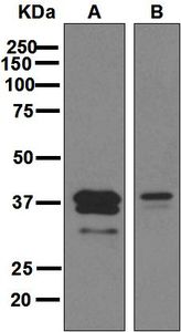 Western blot analysis on (A) human plasma and (B) ovary cancer lysates using anti-APOL1 antibody.