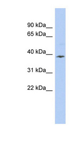 APOL6 / Apolipoprotein L 6 antibody LS-C110112 Western blot of COLO205 cell lysate.