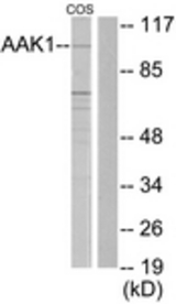 Western blot of extracts from COS7 cells, using AAK1 Antibody. The lane on the right is treated with the synthesized peptide.