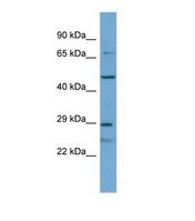 Western blot of Human HeLa. APOLD1 antibody dilution 1.0 ug/ml.
