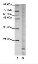 A: Marker, B: HepG2 Cell Lysate