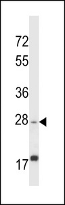 APOOL Antibody western blot of HL-60 cell line lysates (35 ug/lane). The APOOL antibody detected the APOOL protein (arrow).