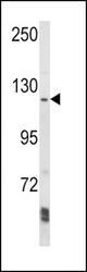 Western blot of AAK1 Antibody in Ramos cell line lysates (35 ug/lane). AAK1 (arrow) was detected using the purified antibody.