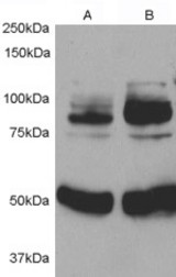 Antibody (0.5 ug/ml) staining of 1) Rat Aortic Smooth Muscle cell lysate 2) after infection with Human APPL1 adenovirus for 48hrs. Detected by chemiluminescence.